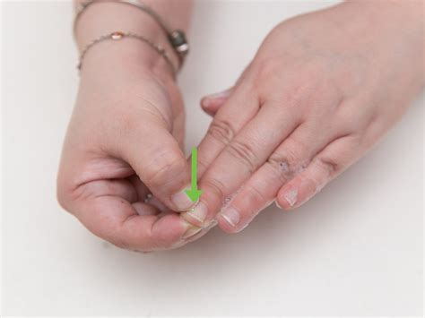 how to remove nail polish from skin 2