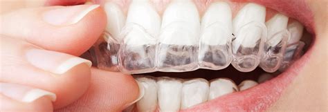 Home Teeth Whitening Custom Trays - The Harley Laser Clinic