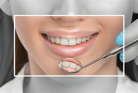 Unlocking the Future with Metal Crowns: Ceramic Alternatives for Perfect Smile Makeovers 1