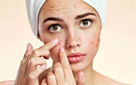 perawatan kulit  tips  kulit  sehat