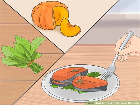 5 Ways to Treat Cystic Acne Naturally - wikiHow Health