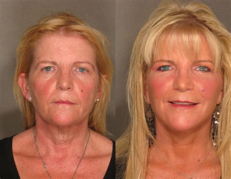 Pure Gold Medical Center