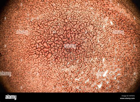 Blutplättchen mikroskop -Fotos und -Bildmaterial in hoher Auflösung – Alamy