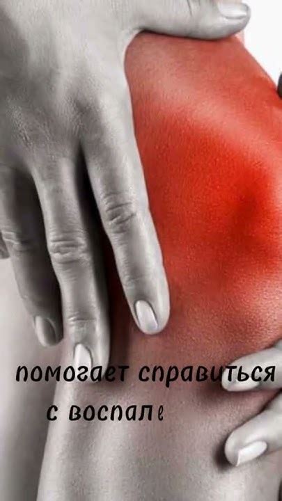 Органическая сера для суставов #msm - YouTube