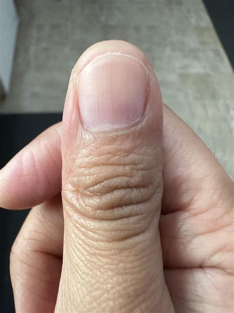 Faint Line on Nails : r/AskDoctorSmeeee