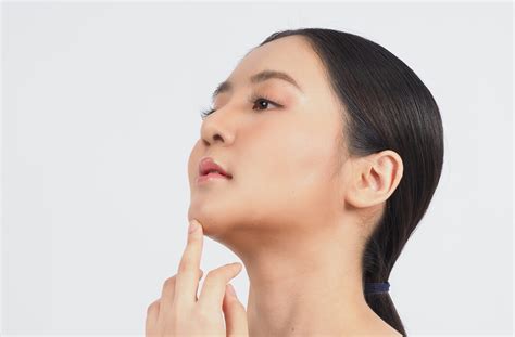Receding Chin | Skin Conditions | Leicester