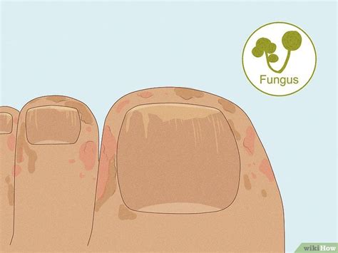 How to Fix a Split Toenail: Causes, Treatments, & More