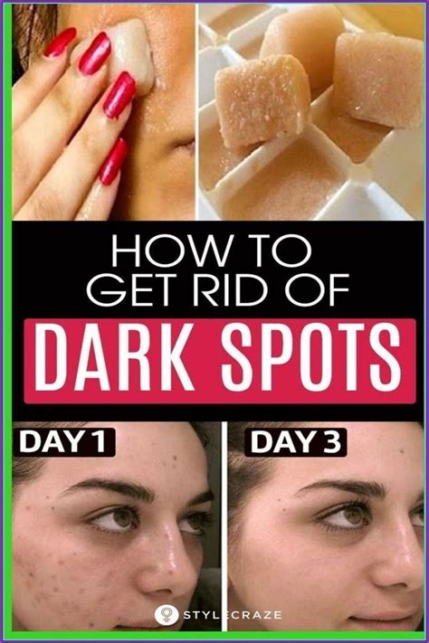 Face Brown Spots Removal – The Right Choice? - PerfecTTips