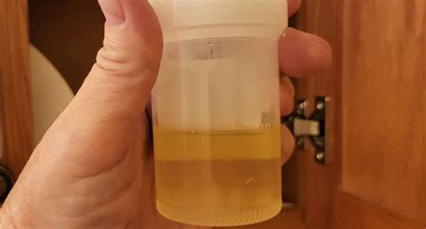 Why is my pee orange? 9 causes - Check4Lead