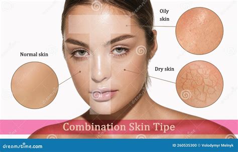 Female Face with Different Skin Types - Dry, Oily, Normal, Combination ...