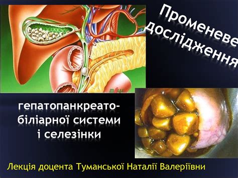 Променеве дослідження гепатопанкреатобіліарної системи і селезінки ...