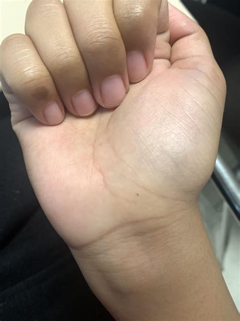 These things keep appearing on my skin. Should I be concerned? : r/medical