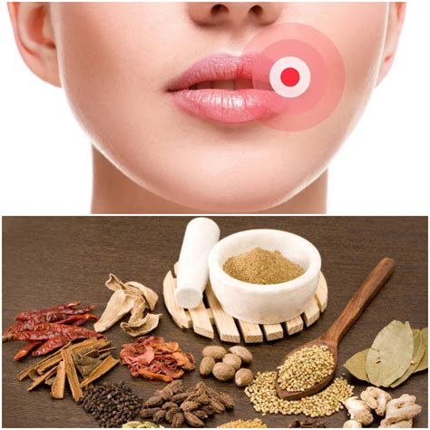 treat cold sores home remedies 8