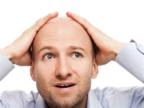 O Que Significa Calva