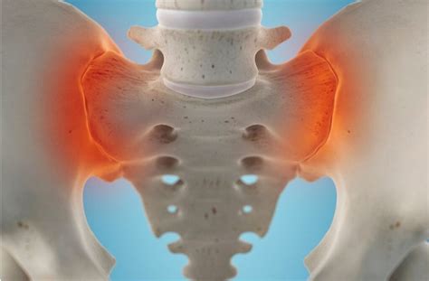 understanding sij dysfunction st leonards physio