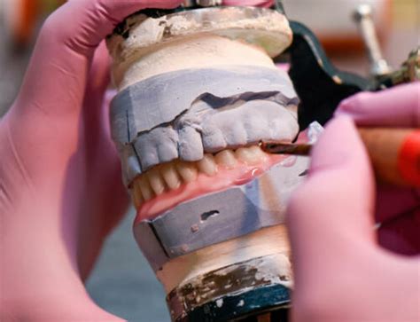 prepare  dentures  denture process start  finish