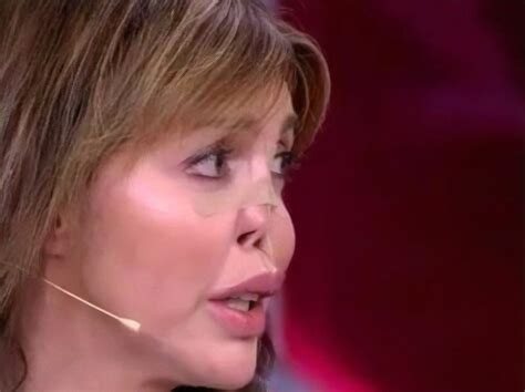 "Это секта". Экс-жена Аршавина, лишившаяся носа, показала лицо и ...