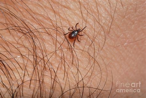 Blacklegged Tick Photograph by John Kaprielian - Pixels