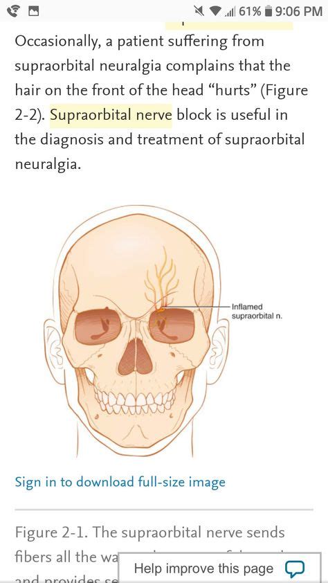 Pin by Erika on my head | Supraorbital nerve, Neuralgia, It hurts