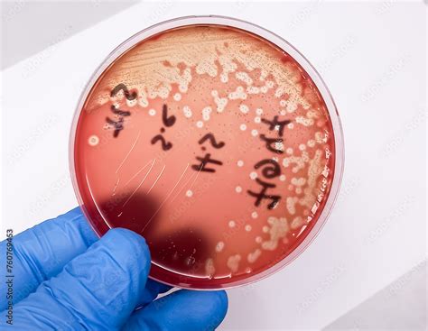 streptococcus bacterial colonies  beta hemolytic  blood