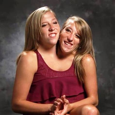 Conjoined twins Abby and Brittany Hensel married | エイジング, 世界観, アメリカン