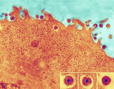 Incubation period for herpes simplex 1. Herpes Simplex Virus ...