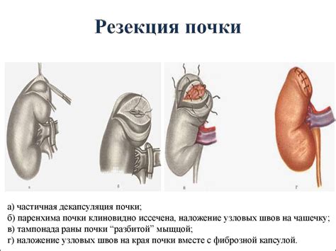 Топографическая анатомия и оперативная хирургия органов таза и ...