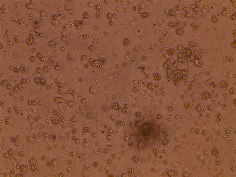 Help, black round dots seen in cell culture, yeast infection