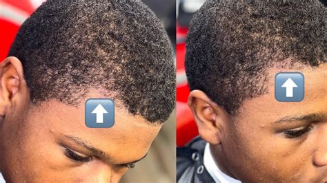 What To Do When Barber Pushed Hairline Back at Edward Gratwick blog