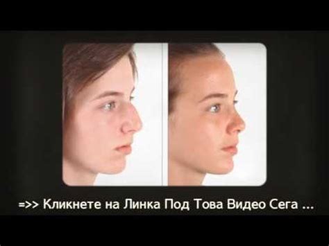 Пластична Операция на Носа Ви - Ринопластика Цени и Мнения от Форумите ...