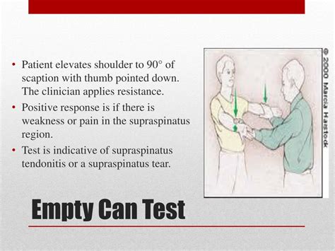 rotator cuff tear algorithm powerpoint