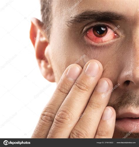 Broken Blood Vessels In Baby Eye - Infoupdate.org