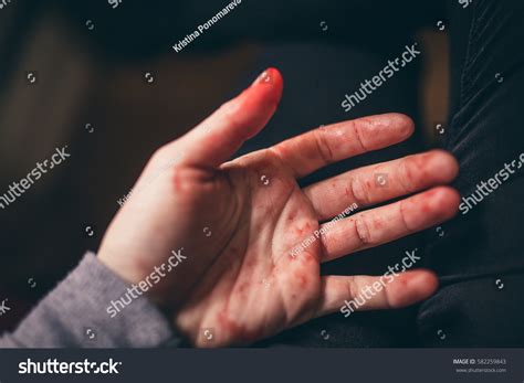 Bloody Hand Stock Photo 582259843 | Shutterstock