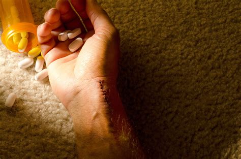 Risk Factors for Recurrent Suicide Attempts in Substance Use Disorder ...