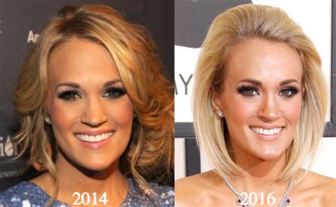 Carrie Underwood Plastic Surgery Before and After Photos - Latest