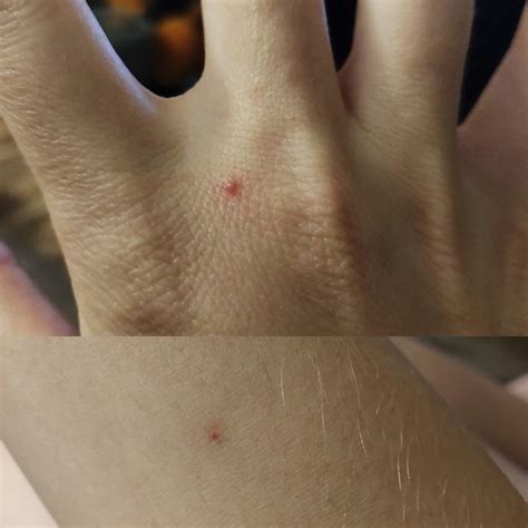 I've always wondered what these red spots are. They show up on