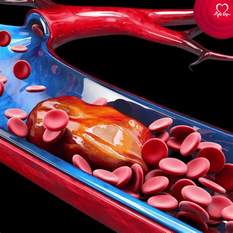 gif  british heart foundation find share  giphy