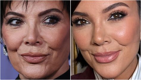 antes  depois de kris jenner causa furor nas redes sociais zappeando