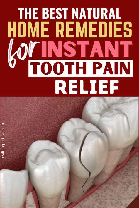 wisdom tooth pain relief