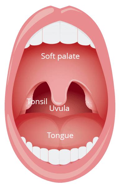 tonsillitis treatment  diagnosis raffles ent centre singapore