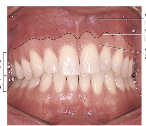 alveolar mucosa diagram quizlet
