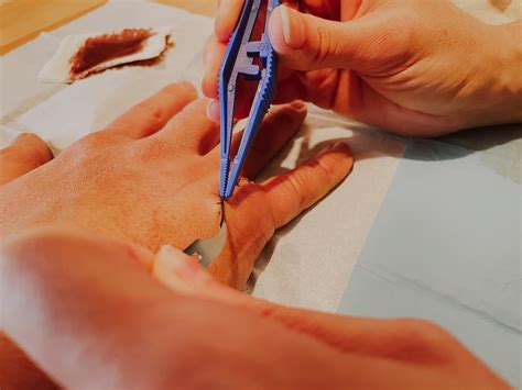 SLM | The Benefits of Working With the Best Hand Surgeons