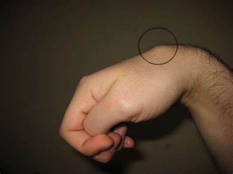 The ArmDoc - Carpal Boss