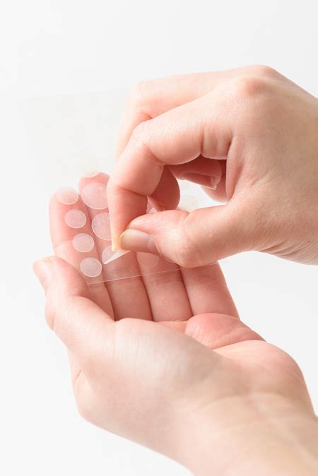 heres   pimple patches dont work      work