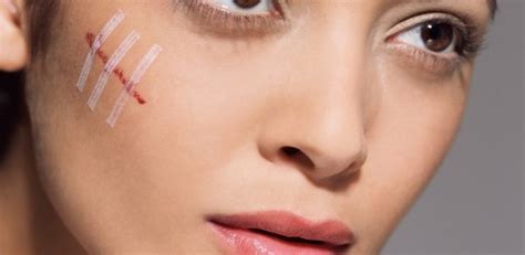 petua menghilangkan parut  efektif  produk