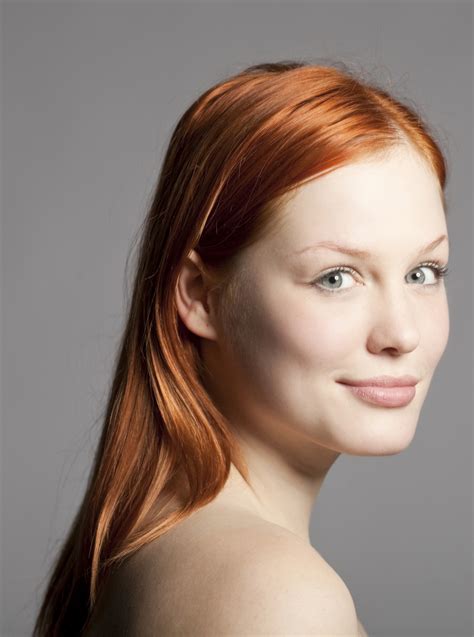 pigment  skin  redheads     susceptible  skin