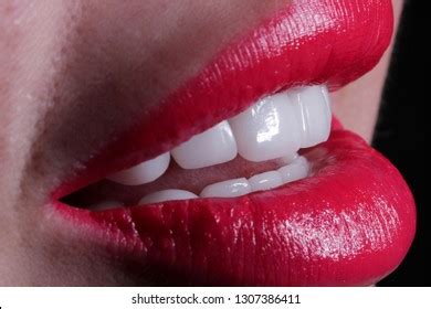 beautiful teeth stock photo  shutterstock