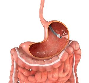 Endoscopic Ultrasound Dubai UAE | Colon Cancer MENA Region, Maldives