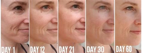 Nucelebs: Before & After Photos You Have To See! - a5wctx4