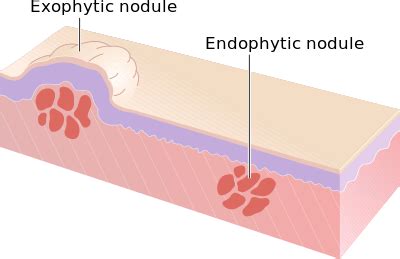 Skin condition - Wikiwand